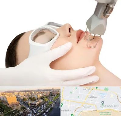 لیزر فرکشنال در تهرانپارس 