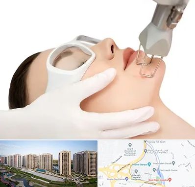 لیزر فرکشنال در المپیک 