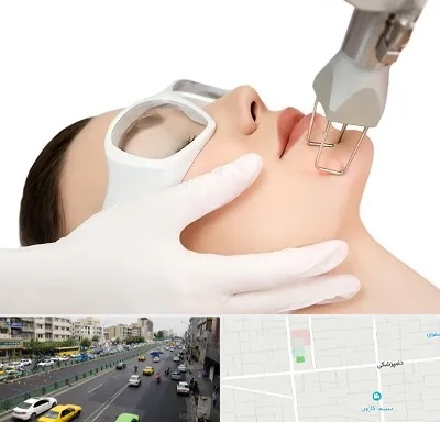 لیزر فرکشنال در خیابان دامپزشکی
