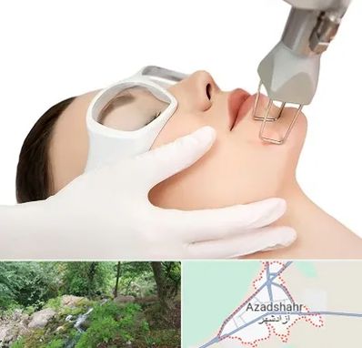 لیزر فرکشنال در آزادشهر