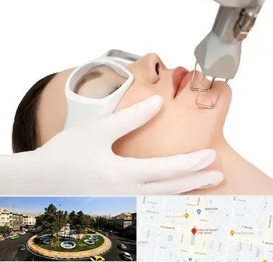 لیزر فرکشنال در هفت حوض 