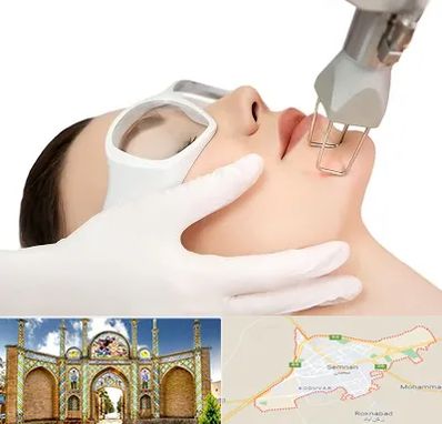 لیزر فرکشنال در سمنان