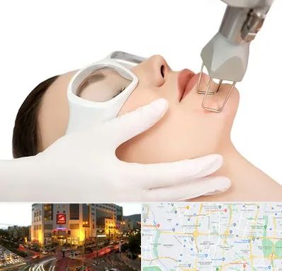 لیزر فرکشنال در جنت آباد تهران 