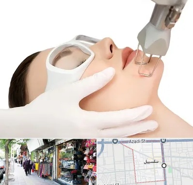 لیزر فرکشنال در سلسبیل