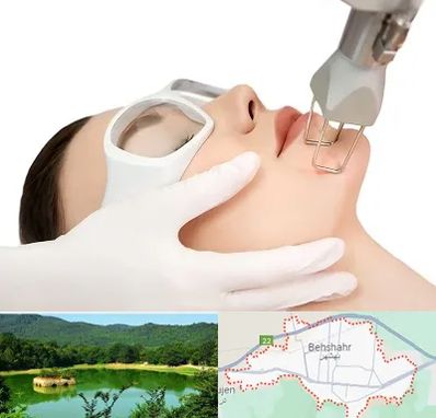 لیزر فرکشنال در بهشهر