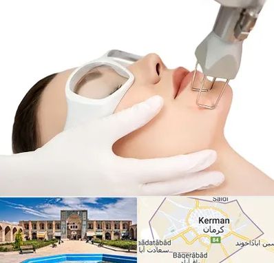 لیزر فرکشنال در کرمان
