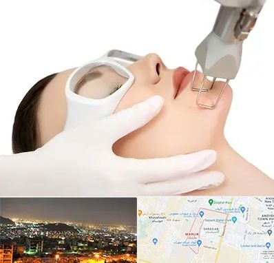 لیزر فرکشنال در مارلیک کرج