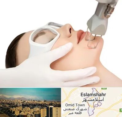 لیزر فرکشنال در اسلامشهر