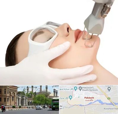 لیزر فرکشنال در پاکدشت