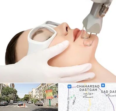 لیزر فرکشنال در چهارصد دستگاه 