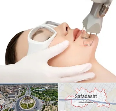 لیزر فرکشنال در صفادشت