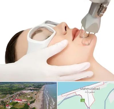 لیزر فرکشنال در محمودآباد