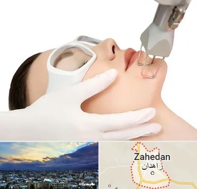 لیزر فرکشنال در زاهدان