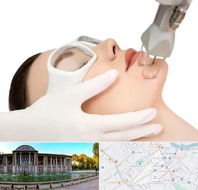 لیزر فرکشنال در عفیف آباد شیراز