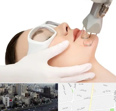 لیزر فرکشنال در زرتشت