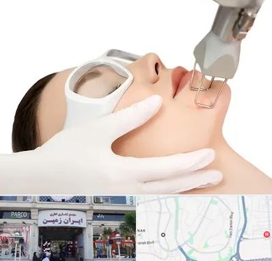 لیزر فرکشنال در ایران زمین