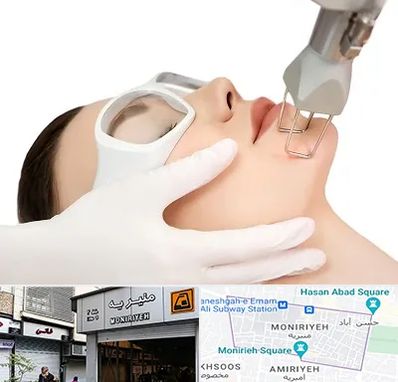 لیزر فرکشنال در منیریه 