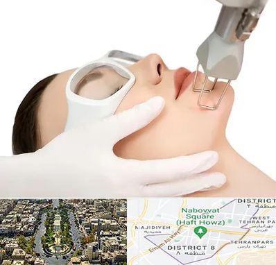 لیزر فرکشنال در نارمک 