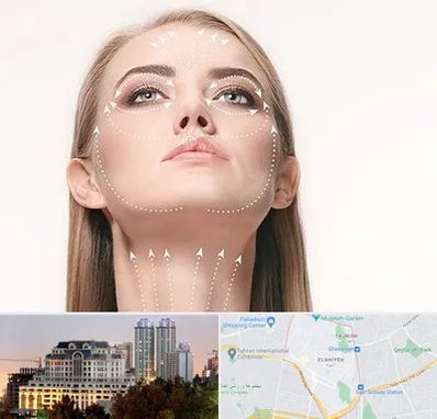 لیفت صورت با نخ در فرشته 