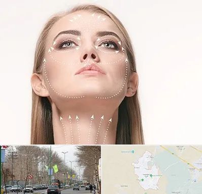 لیفت صورت با نخ در نظرآباد کرج 