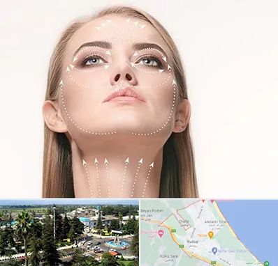 لیفت صورت با نخ در رودسر