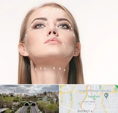 لیفت صورت با نخ در یوسف آباد 