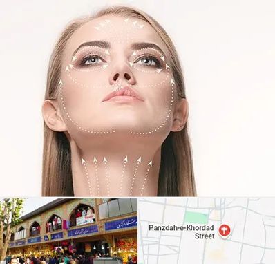 لیفت صورت با نخ در 15 خرداد