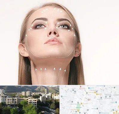 لیفت صورت با نخ در دیباجی 