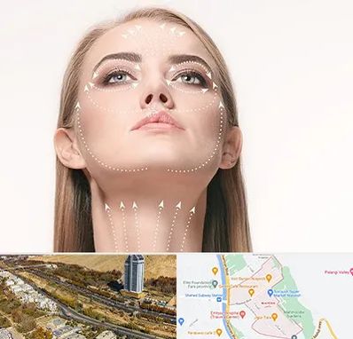 لیفت صورت با نخ در خیابان نیایش شیراز