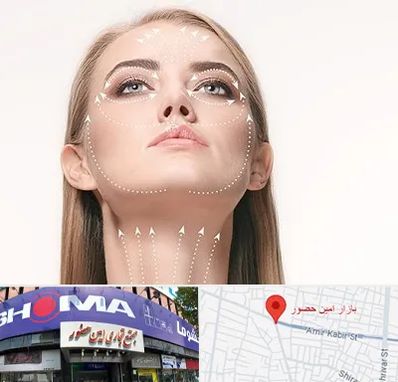 لیفت صورت با نخ در امین حضور