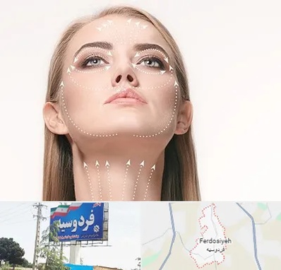 لیفت صورت با نخ در فردوسیه شهریار