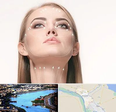 لیفت صورت با نخ در خرمشهر