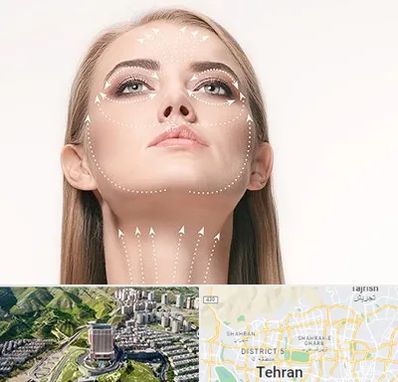 لیفت صورت با نخ در شمال تهران 