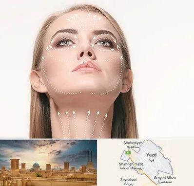 لیفت صورت با نخ در یزد