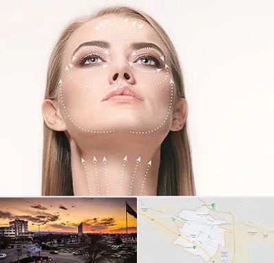 لیفت صورت با نخ در قوچان