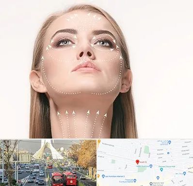 لیفت صورت با نخ در خیابان آزادی 