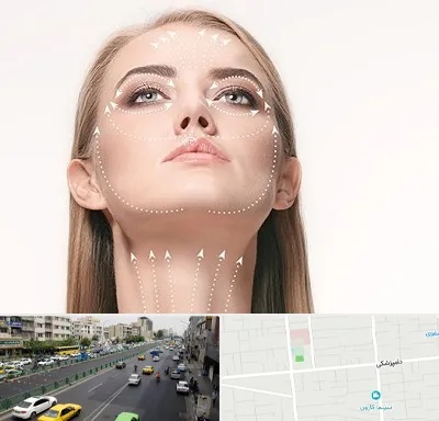 لیفت صورت با نخ در خیابان دامپزشکی