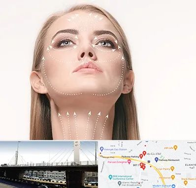 لیفت صورت با نخ در پارک وی 