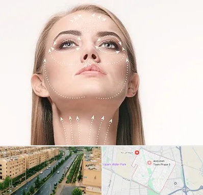 لیفت صورت با نخ در فاز سه اندیشه