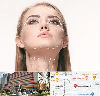 لیفت صورت با نخ در سهروردی 