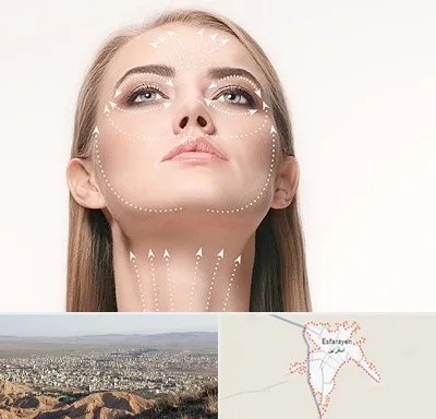 لیفت صورت با نخ در اسفراین