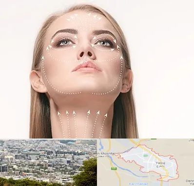 لیفت صورت با نخ در یاسوج