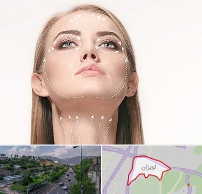 لیفت صورت با نخ در لویزان