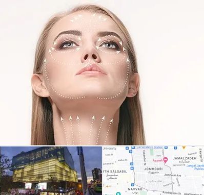 لیفت صورت با نخ در جمهوری 