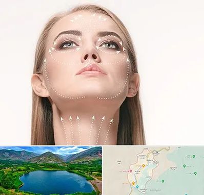 لیفت صورت با نخ در رودبار