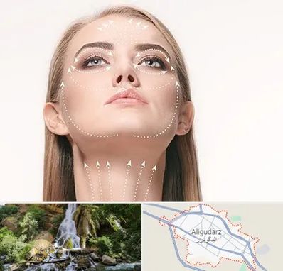 لیفت صورت با نخ در الیگودرز