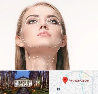 لیفت صورت با نخ در باغ فردوس