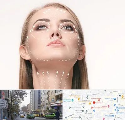 لیفت صورت با نخ در فاطمی 