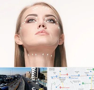 لیفت صورت با نخ در پیروزی 