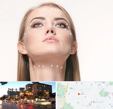 لیفت صورت با نخ در بلوار سجاد مشهد 